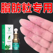 脂肪粒去除膏非藥神器眼部專用去脂肪粒克油膏脂粒眼霜眼周白色除 一盒裝【鞏固裝】