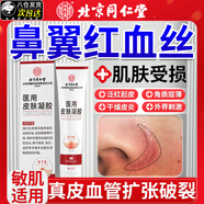 鼻翼脂溢性皮炎兩側(cè)發(fā)紅脫皮藥膏鼻子邊專用修復(fù)面部泛赤血絲去除 鼻子周圍泛紅疼痛臉干起皮