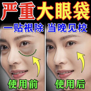 絲幕眼袋去除神器眼袋嚴重問題中老年男女士毒蛇肽眼霜黑眼圈嚴重眼袋 3瓶裝【中度眼袋松弛使用】
