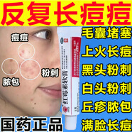 止癢祛痘藥膏祛痘印修復淡化痘印痘坑修復藥膏滿(mǎn)臉痘學(xué)生青春痘去痘痘改善粉刺閉口紅霉素軟膏臉上長(cháng)痘痘用藥 5盒【滿(mǎn)臉痘痘 痘印痘坑】祛痘痘印藥膏