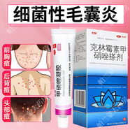 麗芙 甲硝唑凝膠和甲硝銼凝膠+壬二酸凝膠甲硝唑痘痘酒渣鼻外用15%凝膠膏 2件細(xì)菌性毛囊炎】甲硝唑凝膠+克林霉素甲硝唑搽劑