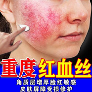 修正紅血絲修復(fù)去除醫(yī)用角質(zhì)層薄皮膚屏障受損泛紅臉敏感肌專(zhuān)用護(hù)膚品 5盒裝【買(mǎi)3送2】大多數(shù)人的選擇
