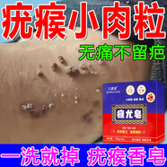 久慕緣克疣皂去瘊疣香皂去瘊疣疣體脫落膏祛疣型去扁平瘊疣尋常瘊疣絲狀瘊肉趾祛疣瘊子去脖子上的小肉粒凝膠專用神器藥水點痣靈除斬草根 【單盒】祛疣專用 脫落神器100%特效專用凝膠