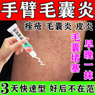 手臂毛囊炎專(zhuān)用藥膏 手臂毛囊炎長(cháng)痘痘胳膊上的小疙瘩毛囊堵塞用什么特新效期藥 皮膚用藥 莫匹羅星軟膏 5盒裝【長(cháng)期手臂毛囊炎】告別毛囊炎