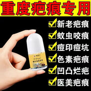 胖東來(lái)甄選疤痕修護(hù)可用刀疤摔傷燙傷增生疤痘坑痘印黑色素精油 五盒【周期淡疤套餐】中度面積用