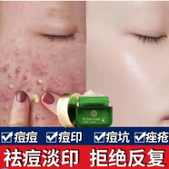 同仁堂煙酰胺美白蘆薈膠祛痘淡化痘印痘疤舒緩曬后修護補水保濕凝 淡化痘印修護 30ml