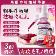 臻羞刷酸果酸醫(yī)用果酸水楊酸精華液煥膚原液修復(fù)祛黑色素沉淀去閉口收 30m一瓶體驗裝 所有膚質(zhì)可用