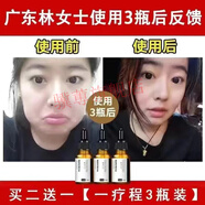 腫眼泡法國雙眼皮精華擴眼精油神器去腫單眼皮內雙變外雙美眼技術(shù) 3瓶裝【買(mǎi)二送一】