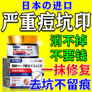 秋雅奈緒痘坑修復(fù)凹洞填充再生祛痘印去除痘坑凹陷性疤痕修復(fù)醫(yī)用專用膏藥 特效：買二送一【快速修復(fù)填充】