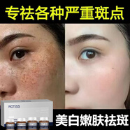 ROTiSS美白嫩膚祛斑霜提亮保濕面霜黃褐斑雀斑煙酰胺改善暗黃肌膚 一盒裝