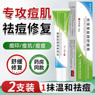 素秀臣氏積雪草苷軟膏復顏舒緩淡化痘印坑修復霜祛痘膏保濕學(xué)生青春痘男女 2支【鉅惠裝】