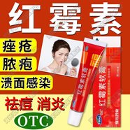福元 紅霉素軟膏 10g 祛痘藥膏痤瘡青春痘膿包瘡化膿性皮膚病及燙傷燒傷潰瘍面感染消炎乳膏 本品2盒+2盒阿達(dá)帕林凝膠【祛痘祛粉刺快】贈(zèng)棉簽