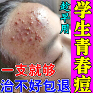 【藥房直售】青春痘祛痘膏男女學(xué)生青少年額頭長(cháng)上長(cháng)痘痘閉口粉刺去豆豆 買(mǎi)三送二