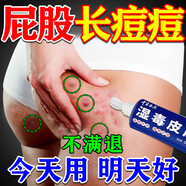 千草本原屁股癢長(zhǎng)痘痘久坐濕癢疹坐瘡起疙瘩止癢膏屁股濕癢硬塊紅腫火癤子 5盒【拒絕反復(fù)】