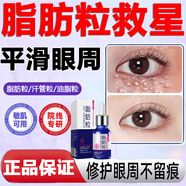 汗管瘤脂肪粒眼部專用去除膏可搭去除神器顆粒清肌精華液眼部汗管粒油脂粒男女通用 （單盒裝)體驗裝