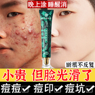 南京同仁堂祛痘膏祛痘印修復(fù)淡化痘印痘坑修復(fù)男女士青春痘粉刺去痘痘和痘印 一盒裝【買二贈一】