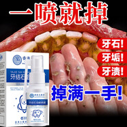 香港大藥房牙結(jié)石溶解牙石速效口腔去除器沖洗牙齒去黃牙結(jié)石噴霧膏去味口臭 告別牙結(jié)石】1瓶裝