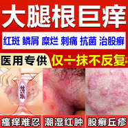 股蘚股癬專(zhuān)用藥膏大腿根內(nèi)側(cè)潮濕瘙癢股癬發(fā)黑男士私處止癢體癬花斑癬銅錢(qián)癬真菌感染克霉唑乳膏素噴霧劑軟膏 3盒腹股溝股癬膏大腿內(nèi)側(cè)濕疹陰囊皮膚用藥發(fā)貨特效快