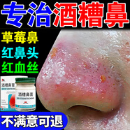 韓夕夢(mèng)酒糟鼻草莓鼻去黑頭收縮毛孔修復紅鼻子專(zhuān)用去鼻頭腫翼膏藥 買(mǎi)3送2   實(shí)發(fā)5盒