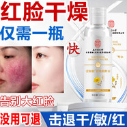 同仁堂修護紅血絲精華液敏感肌增厚角質(zhì)層臉部泛紅過(guò)敏皮膚祛痘控油精華 祛紅血絲精華【3瓶裝 第3瓶0元】