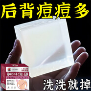L0【凈背部痘痘】背粒消前胸后背長痘身體除螨沐浴去痘印美背手工皂 一盒體驗(yàn)裝