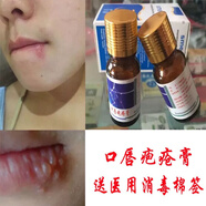 唇福堂修復嘴唇瘡口上火起泡防嘴角起水泡結痂癢爛滋潤護理草本膏