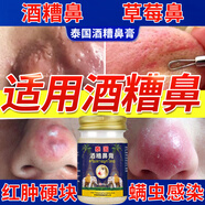 克頓默奧酒糟鼻草莓鼻紅腫玫瑰痤瘡紅鼻子專用去粉刺黑頭紅血絲螨蟲修護軟 一盒初期裝（輕微型） 搭紅鼻子酒糟鼻頭紅腫產品用