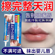君霖水辛辛苦露唇炎膏【正品旗艦】專用的藥慢性嘴唇干裂醫(yī)用級潤唇膏 5支裝 還你一個水嫩唇 買三送二 官方正品