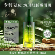 馥珮祛痘精華液淡化痘印改善干燥補水保濕水控油平衡清潔滋潤膚色護膚 30ml1瓶