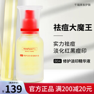 HomeFacialPro HFP寡肽原液祛痘淡印修護(hù)油皮痘肌痘坑去粉刺舒緩修復(fù)精華液男女 祛痘淡印精華 15ml (1瓶)