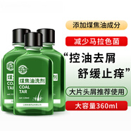 西域霸王煤焦油洗劑洗發(fā)水頭皮癢脂溢性抑菌去頭油頭屑西域霸王 [3瓶裝]深度清潔預(yù)防反復(fù)