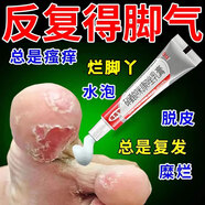達(dá)克寧腳氣藥止癢脫皮爛腳丫真菌感染治腳氣硝酸咪康唑乳膏腳臭腳氣止癢藥真菌感染治腳氣的特藥皮膚用藥 非處方藥 1盒【腳氣專(zhuān)用藥 國(guó)藥準(zhǔn)字】達(dá)克寧硝酸咪康唑乳膏 達(dá)克寧腳氣藥止癢脫皮爛腳丫真菌感染治腳氣