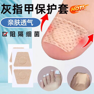 灰指甲保護套腳趾甲遮丑貼上藥抹藥包甲套膠布專(zhuān)遮擋灰指甲專(zhuān)用液 膚色指甲貼[100貼]