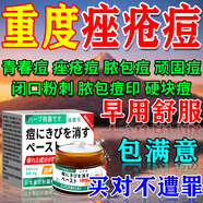 東田祛痘消炎痤瘡專用學(xué)生青少年藥膏硬疙瘩粉刺青春痘印修復(fù)淡化中藥 買2送1【頑固痤瘡修復(fù)】 去痘痘和痘印