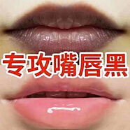 唇周黑去黑嘴角發(fā)黑唇周暗沉去除黑色素改善嘴唇暗沉淡化唇角邊黑 特效【好后永不再范】5瓶 75ml 改善烏唇黑唇精華霜