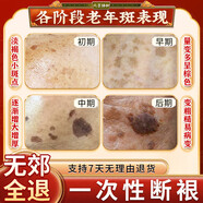 修芙儷 ELTA MD 100PURE去老人斑用藥膏一擦就掉強(qiáng)力除老年黑 買5贈(zèng)4(晚期老年斑推薦)