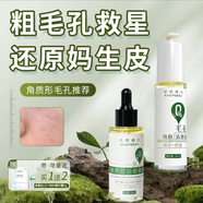 依思佩爾煥膚清理液溫和祛舊角質(zhì)護理改善毛孔粗糙控油溫和不傷膚 80ml【超值優(yōu)選】角質(zhì)形毛孔套裝 油性及混合偏油膚質(zhì)