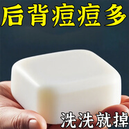 L0【凈背部痘痘】背粒消前胸后背長痘身體除螨沐浴去痘印美背手工皂 三盒裝【推薦中度螨蟲痘痘】