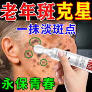 巖井昃弘祛斑點(diǎn)斑專(zhuān)用水藥去斑霜去黑色素臉部手背醫用正品老年斑曬斑進(jìn)口 【效果不佳】1盒美白祛斑霜 祛斑霜老年斑專(zhuān)用特效非藥一夜消