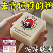 L0【凈背部痘痘】背粒消前胸后背長痘身體除螨沐浴去痘印美背手工皂 兩盒裝【推薦輕度螨蟲痘痘】