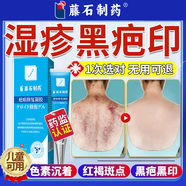濕疹淡化黑印專用膏黑印可搭去除祛濕疹疤痕退黑色素沉淀黑斑點非修復藥膏去除兒童腿上后背痘印疤印醫(yī)用N3 送棉簽【1盒體驗裝】濕疹黑色素沉淀專用膏
