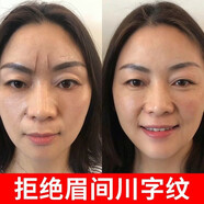 韓倫美羽（HUNMUI）水滴川字紋貼膜抬頭紋法令紋貼淡化眉間紋懸針紋額頭紋貼提拉緊致 川字紋貼1盒（0.6g*24貼）