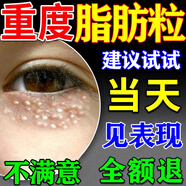 脂肪粒去除藥膏神器眼部專(zhuān)用眼霜消除汗管瘤脂肪油脂粒粟丘疹克星 特效:買(mǎi)3送2【強烈推薦】