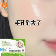 積雪草苷霜軟膏復顏膏去黑色素修復淡化祛痘印斑毛孔粗大改善皮膚 收縮毛孔【粗毛孔專(zhuān)用/嫩滑肌膚】1支
