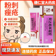 阿達(dá)帕林凝膠改善毛孔粗大醫(yī)用祛痘消炎痤瘡專用祛痘膏祛痘淡化痘印痤瘡痘痘粉刺祛痘印修復(fù)淡化痘印痘坑凝膠 1盒裝【用于面部背部胸口粉刺痤瘡痘痘】