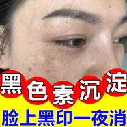 臉上黑色素沉淀去除臉部排毒排黑色素臉上黑印淡化色素沉著(zhù)結痂黑印痘印曬斑淡斑美白修復 一盒體驗裝