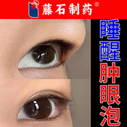 眼皮消腫神器晨起消腫貼睡醒腫眼泡消除眼睛水腫藍莓葉黃素眼皮上水腫消腫專(zhuān)用冰敷眼貼上眼皮去浮腫消腫O6 買(mǎi)2送1【3盒裝】經(jīng)常水腫、睜不開(kāi)眼（糖尿病引起）