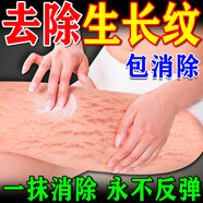 安奈雅妊娠紋修復(fù)霜產(chǎn)后去除消除緊致肚皮淡化生長(zhǎng)紋孕婦預(yù)防專用藥膏油 9盒裝【買5送4】告別小丑妊娠紋