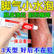 達(dá)克寧腳氣藥止癢脫皮爛腳丫真菌感染治腳氣硝酸咪康唑乳膏腳臭腳氣止癢藥真菌感染治腳氣的特藥皮膚用藥 非處方藥 5盒【腳氣傳染一家人】家庭常備裝 達(dá)克寧腳氣藥止癢脫皮爛腳丫真菌感染治腳氣