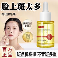 榆奈兒尋斑記美白祛斑精華液淡化色斑溫和不刺激深層滋養護膚精油 【藥房直售】1盒裝